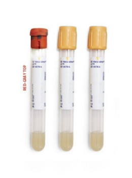 BD Vacutainer® SST™ Plastic Tubes