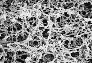 Osmonics AcetatePlus Supported Cellulose Acetate Filters